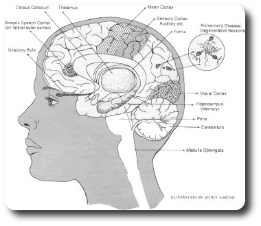 Alzheimers Disease Brain