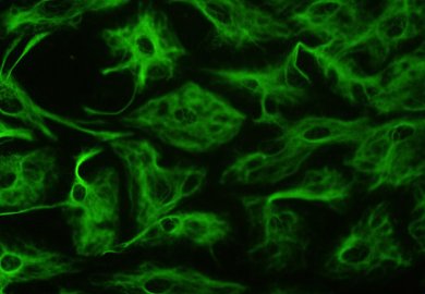 Astroglial cells (Astrocytes)